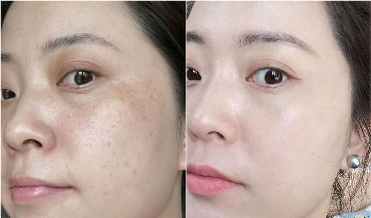 Khám Phá Tác Dụng Của Melatonin Trong Dưỡng Da – Bí Mật Đằng Sau Làn Da Không Tuổi 2 Tác dụng của melatonin