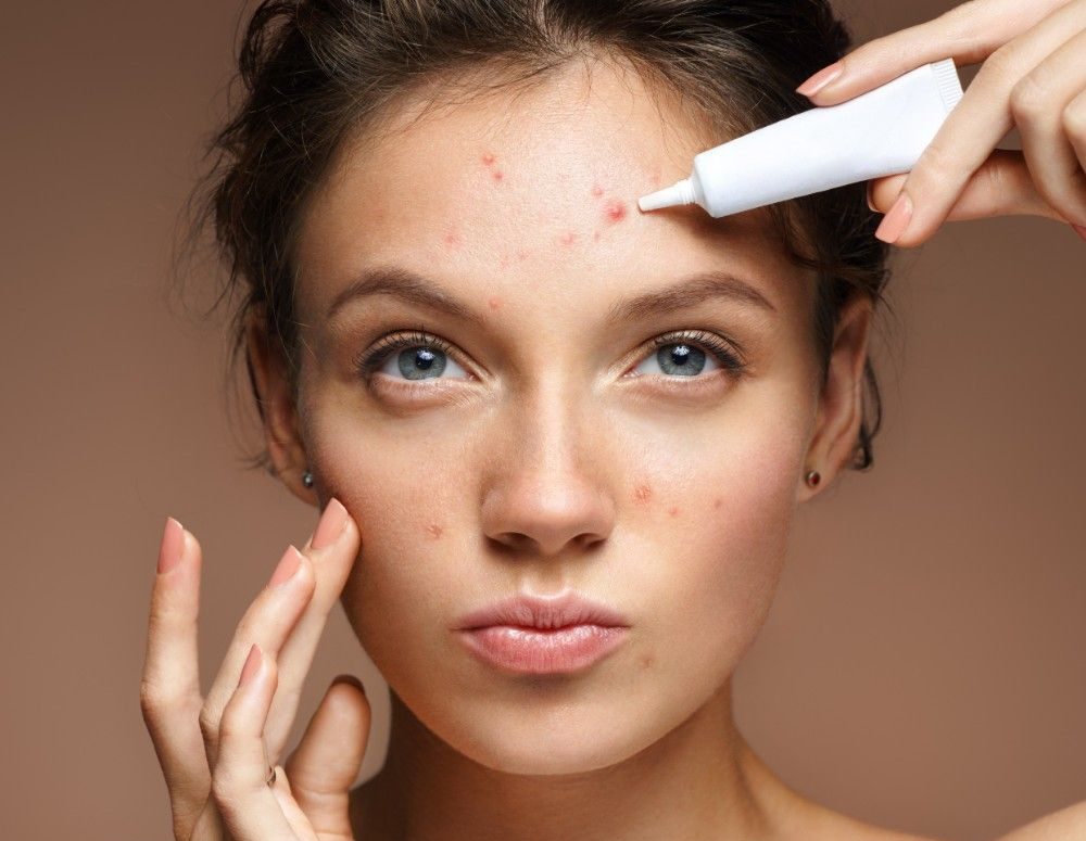 chấm mụn nào tốt