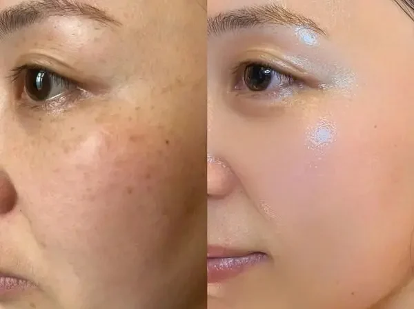 serum hàn quốc chống lão hóa